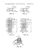 DEVICE AND METHOD FOR ESTABLISHING AN ARTIFICIAL ARTERIO-VENOUS FISTULA diagram and image