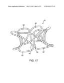 DEVICE AND METHOD FOR ESTABLISHING AN ARTIFICIAL ARTERIO-VENOUS FISTULA diagram and image