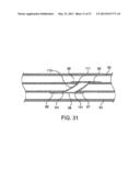 DEVICE AND METHOD FOR ESTABLISHING AN ARTIFICIAL ARTERIO-VENOUS FISTULA diagram and image