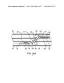 DEVICE AND METHOD FOR ESTABLISHING AN ARTIFICIAL ARTERIO-VENOUS FISTULA diagram and image