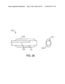 DEVICE AND METHOD FOR ESTABLISHING AN ARTIFICIAL ARTERIO-VENOUS FISTULA diagram and image