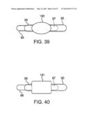 DEVICE AND METHOD FOR ESTABLISHING AN ARTIFICIAL ARTERIO-VENOUS FISTULA diagram and image