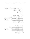 DEVICE AND METHOD FOR ESTABLISHING AN ARTIFICIAL ARTERIO-VENOUS FISTULA diagram and image