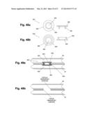 DEVICE AND METHOD FOR ESTABLISHING AN ARTIFICIAL ARTERIO-VENOUS FISTULA diagram and image