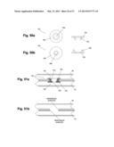 DEVICE AND METHOD FOR ESTABLISHING AN ARTIFICIAL ARTERIO-VENOUS FISTULA diagram and image