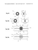 DEVICE AND METHOD FOR ESTABLISHING AN ARTIFICIAL ARTERIO-VENOUS FISTULA diagram and image