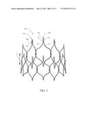 ENDOLUMINAL PROSTHESIS INTRODUCER diagram and image