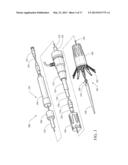 ENDOLUMINAL PROSTHESIS INTRODUCER diagram and image