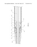 ENDOLUMINAL PROSTHESIS INTRODUCER diagram and image