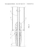 ENDOLUMINAL PROSTHESIS INTRODUCER diagram and image