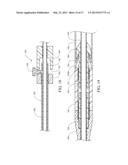 ENDOLUMINAL PROSTHESIS INTRODUCER diagram and image