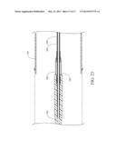 ENDOLUMINAL PROSTHESIS INTRODUCER diagram and image