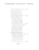 BIOABSORBABLE POLYMERIC MEDICAL DEVICE diagram and image