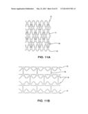 BIOABSORBABLE POLYMERIC MEDICAL DEVICE diagram and image