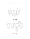 BIOABSORBABLE POLYMERIC MEDICAL DEVICE diagram and image