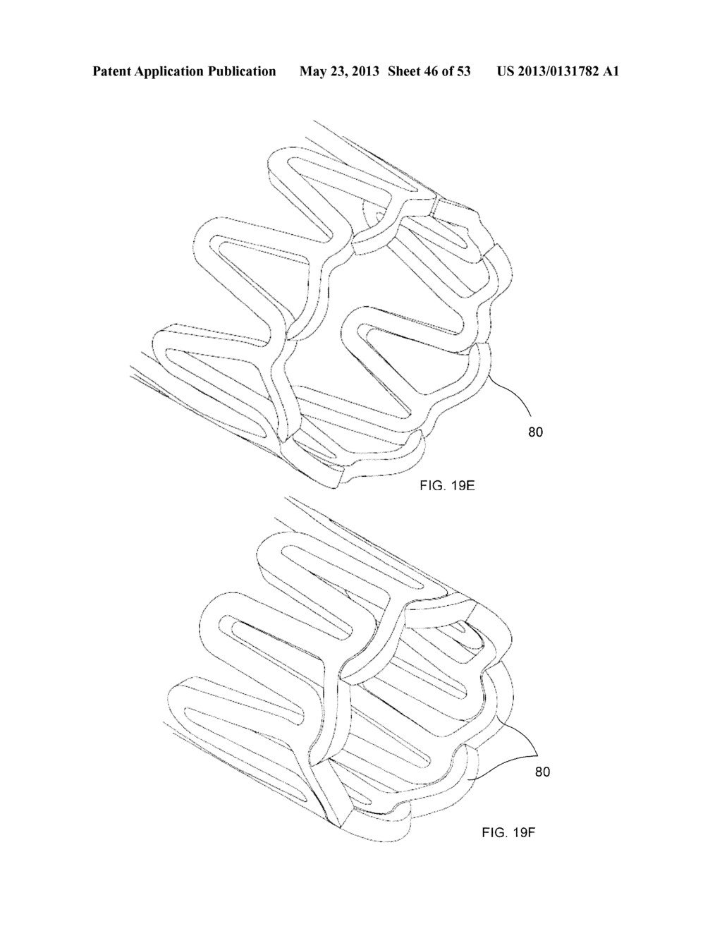 BIOABSORBABLE POLYMERIC MEDICAL DEVICE - diagram, schematic, and image 47