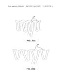 BIOABSORBABLE POLYMERIC MEDICAL DEVICE diagram and image