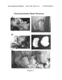 Joint Repair Using Mesenchymal Stem Cells diagram and image