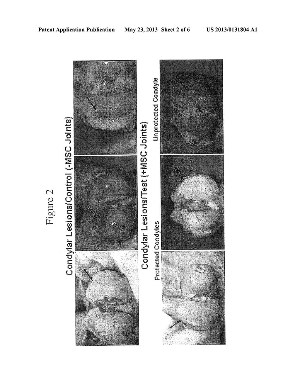 Joint Repair Using Mesenchymal Stem Cells - diagram, schematic, and image 03