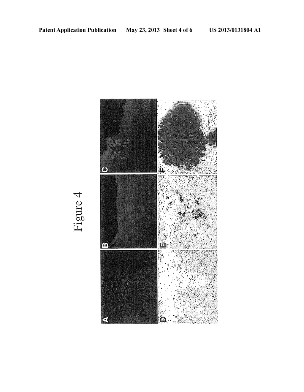 Joint Repair Using Mesenchymal Stem Cells - diagram, schematic, and image 05