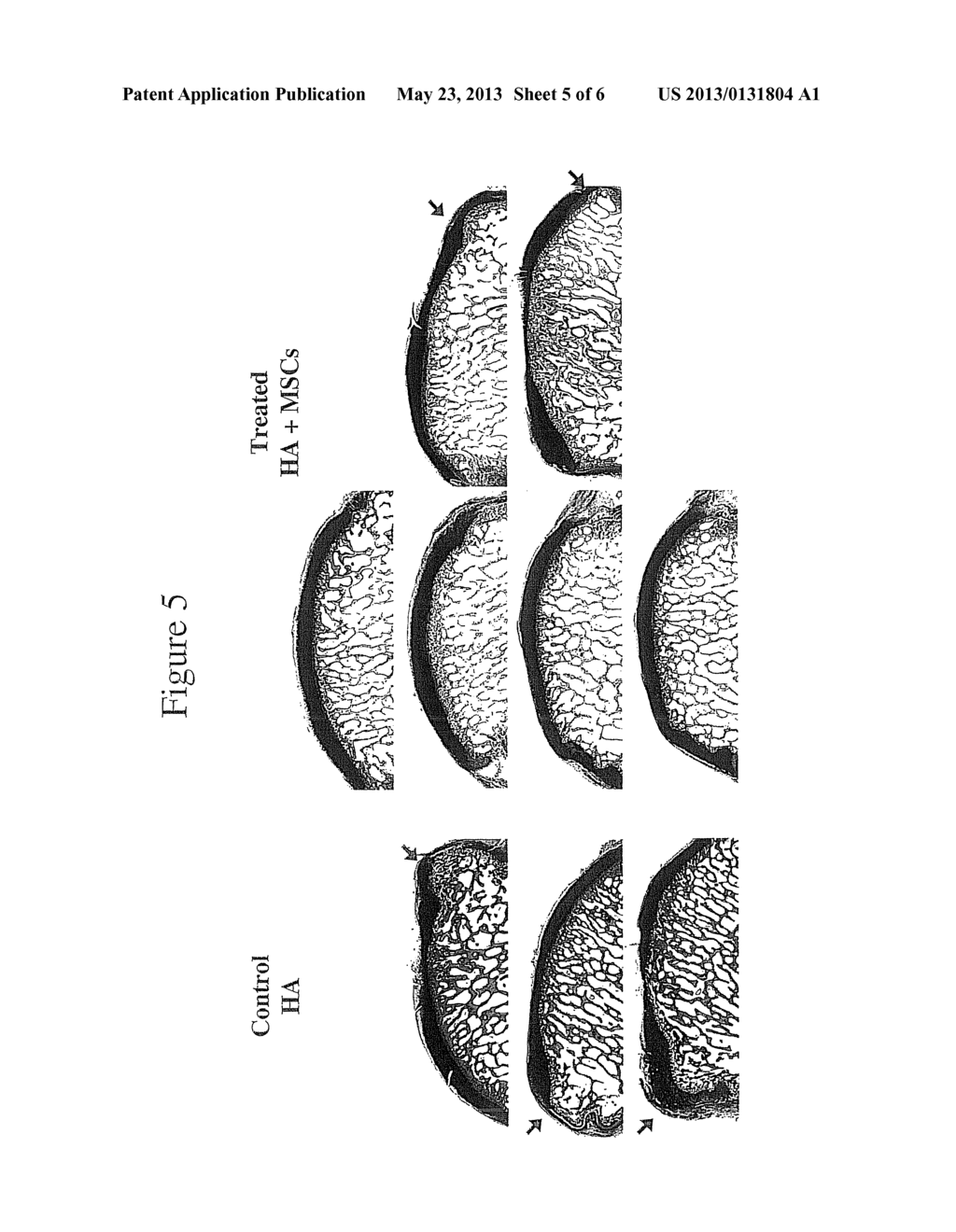 Joint Repair Using Mesenchymal Stem Cells - diagram, schematic, and image 06