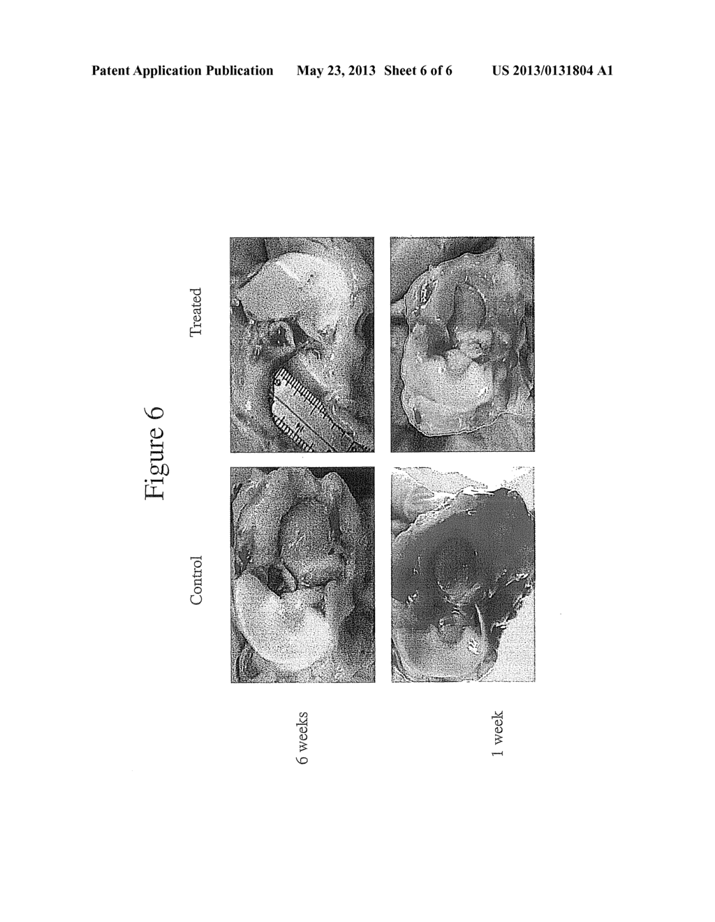 Joint Repair Using Mesenchymal Stem Cells - diagram, schematic, and image 07