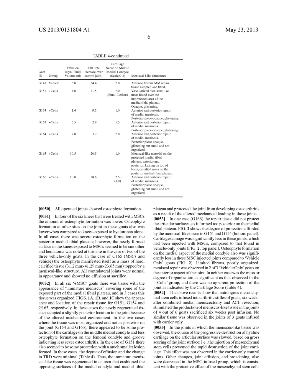 Joint Repair Using Mesenchymal Stem Cells - diagram, schematic, and image 13