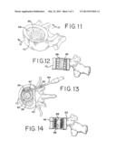 APPARATUS AND METHOD FOR TREATING BONE diagram and image