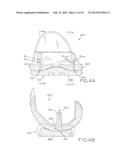 TIBIAL BEARING COMPONENT FOR A KNEE PROSTHESIS WITH IMPROVED ARTICULAR     CHARACTERISTICS diagram and image