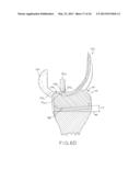 TIBIAL BEARING COMPONENT FOR A KNEE PROSTHESIS WITH IMPROVED ARTICULAR     CHARACTERISTICS diagram and image