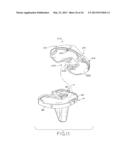 TIBIAL BEARING COMPONENT FOR A KNEE PROSTHESIS WITH IMPROVED ARTICULAR     CHARACTERISTICS diagram and image