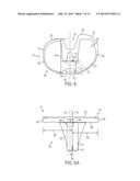 TIBIAL BASEPLATE WITH ASYMMETRIC PLACEMENT OF FIXATION STRUCTURES diagram and image