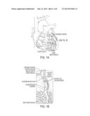 Method and System for Multi-Scale Anatomical and Functional Modeling of     Coronary Circulation diagram and image