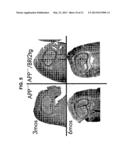 TRANSGENIC MAMMALLS MODIFIED IN BRI PROTEIN EXPRESSION diagram and image