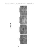 TRANSGENIC MAMMALLS MODIFIED IN BRI PROTEIN EXPRESSION diagram and image