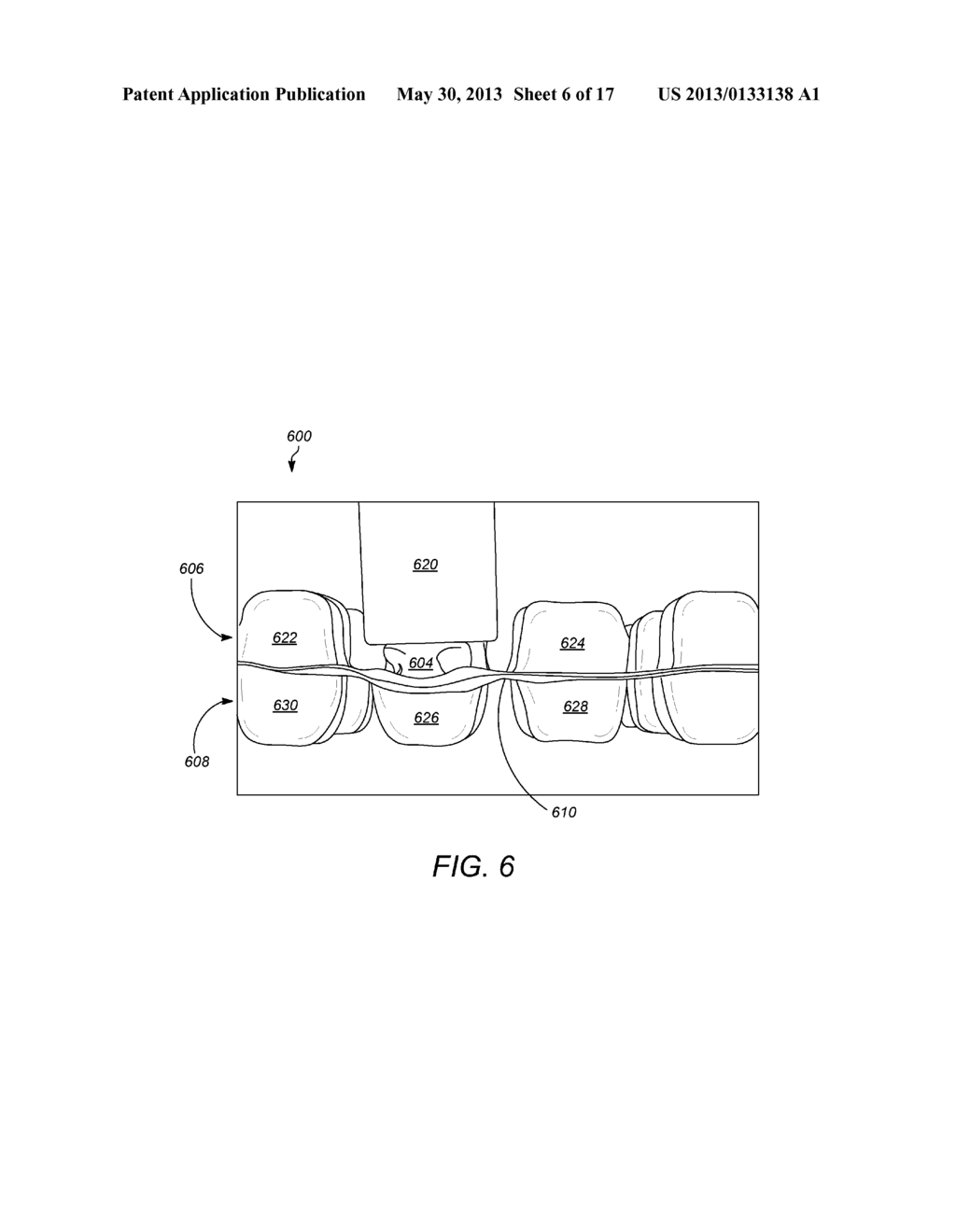 Cellular Cushion - diagram, schematic, and image 07