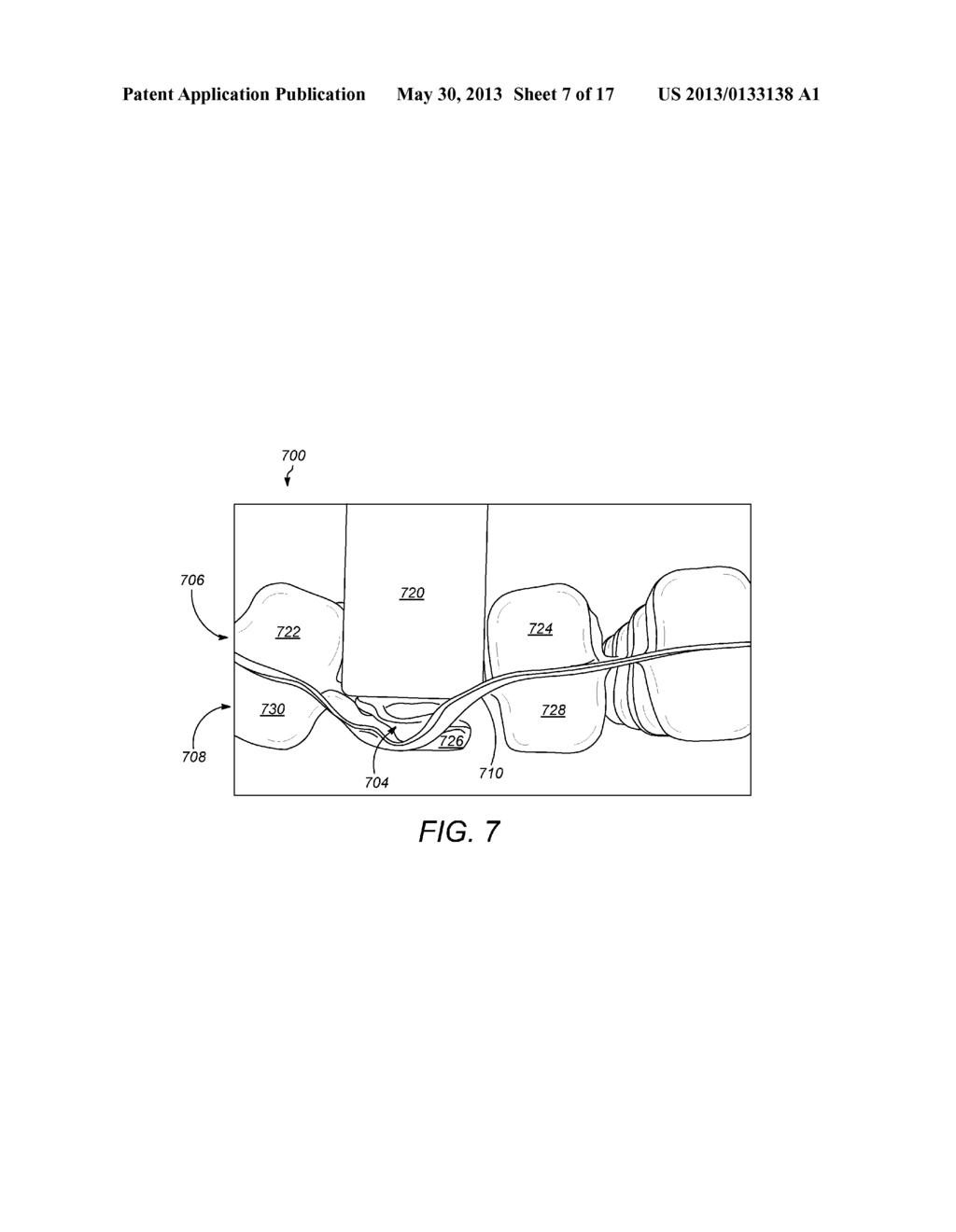 Cellular Cushion - diagram, schematic, and image 08