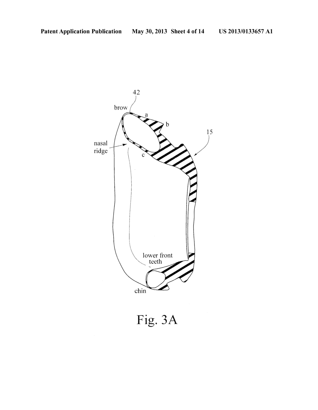 METHOD AND APPARATUS FOR ADJUSTING RESPIRATORY MASK SEALING FORCE - diagram, schematic, and image 05