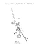 MINIMALLY INVASIVE SURGICAL STABILIZATION DEVICES AND METHODS diagram and image