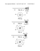 MINIMALLY INVASIVE SURGICAL STABILIZATION DEVICES AND METHODS diagram and image