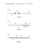 MINIMALLY INVASIVE SURGICAL STABILIZATION DEVICES AND METHODS diagram and image