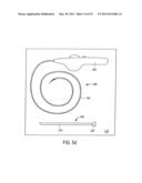 MINIMALLY INVASIVE SURGICAL STABILIZATION DEVICES AND METHODS diagram and image