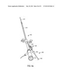 MINIMALLY INVASIVE SURGICAL STABILIZATION DEVICES AND METHODS diagram and image