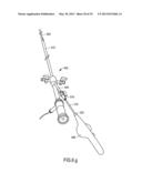 MINIMALLY INVASIVE SURGICAL STABILIZATION DEVICES AND METHODS diagram and image