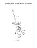 MINIMALLY INVASIVE SURGICAL STABILIZATION DEVICES AND METHODS diagram and image