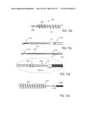 MINIMALLY INVASIVE SURGICAL STABILIZATION DEVICES AND METHODS diagram and image