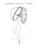 STORAGE CASE FOR ARTICLES diagram and image