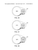 FILTER TURNING MECHANISM diagram and image