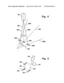 System and Method for Determining the Orientation of an Eye diagram and image