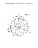 System and Method for Determining the Orientation of an Eye diagram and image